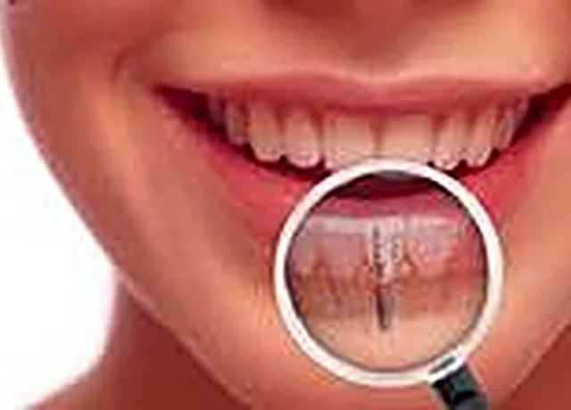 Dental implant treatment at Easy Dental Care Center in Norcross, GA
